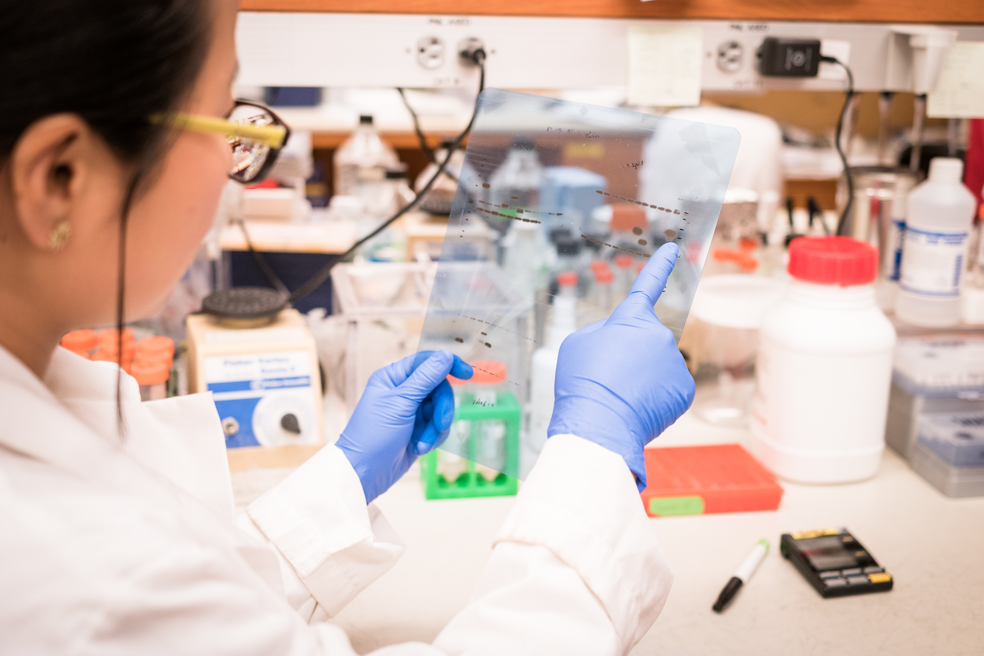 Analyzing,Gel,Results