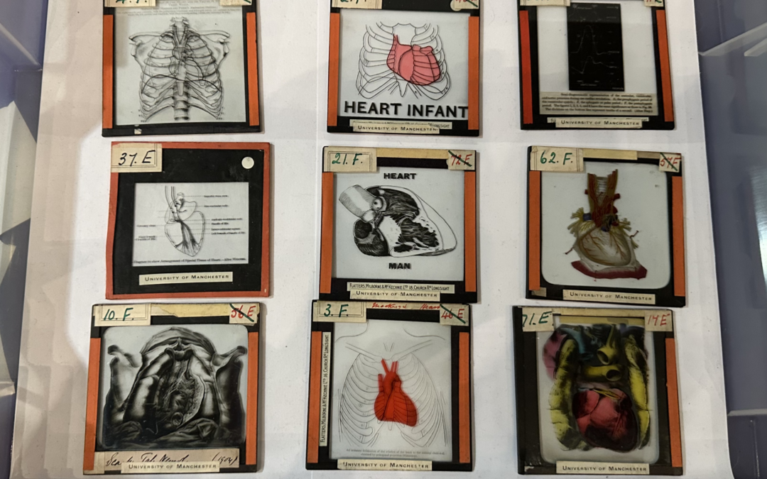 Heart Health History – The Museum of Medicine and Health at British Science Week