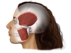 Picture indicates a side of a person's head with outlined internal muscles. Figure 1. ‘The Muscles of Mastication 1’ by Lois Jane Holt. Used with permission from Lois Jane Holt Copyright © 2024. 