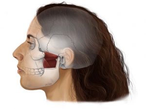 Picture indicates a side of a person's head with outlined internal muscles. Figure 2. ‘The Muscles of Mastication 2’ by Lois Jane Holt. Used with permission from Lois Jane Holt Copyright © 2024