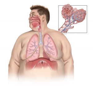 A person with outlined internal muscles and organs. Figure 3. Normal respiratory system by Ni-ka Ford. Used with permission from Ni-ka Ford Copyright © 2024